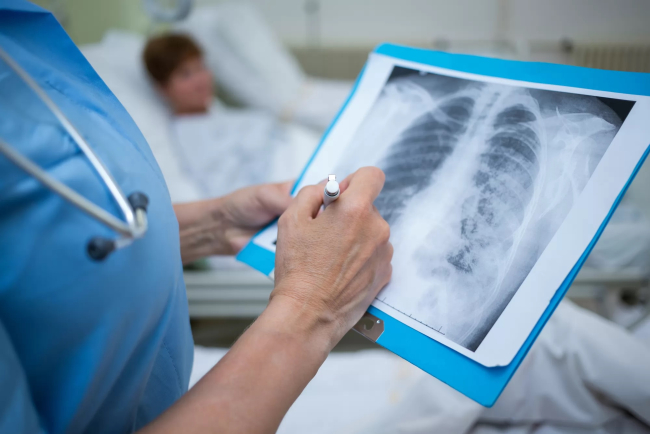 Україна отримала інноваційний препарат для профілактичного лікування туберкульозу, - МОЗ