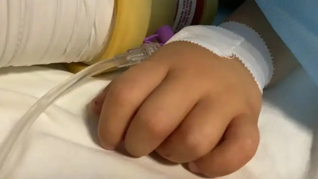 Львівські лікарі видалили з нирки дитини 24-сантиметровий камінь: хлопчик - із Донеччини та має ДЦП