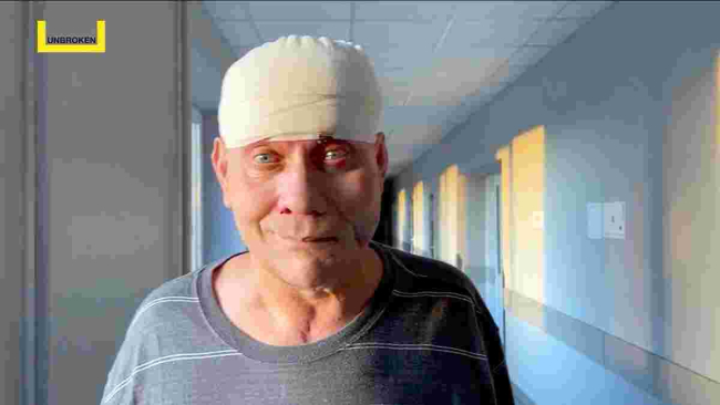Хірурги пересадили мешканцю Херсонщини м'яз зі спини на голову